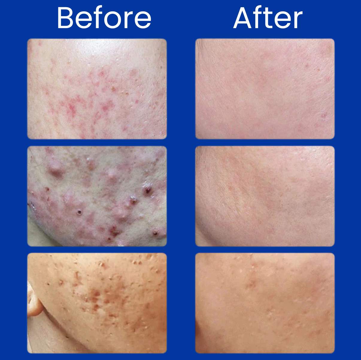 Lumé™ A313 Revival Cream