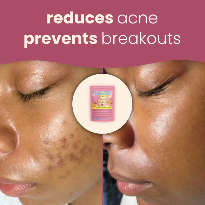 GlowBoost™ Turmeric Pads