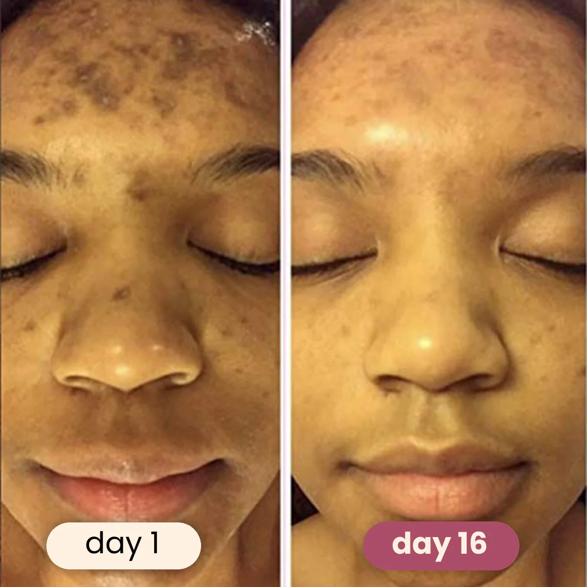 GlowBoost™ Turmeric Pads