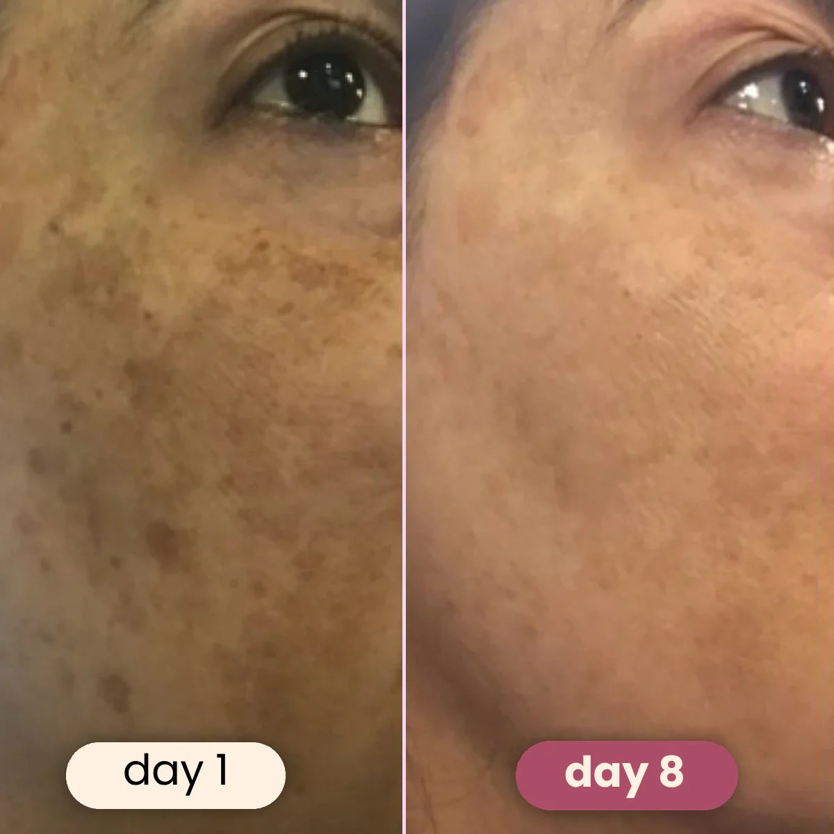 GlowBoost™ Turmeric Pads