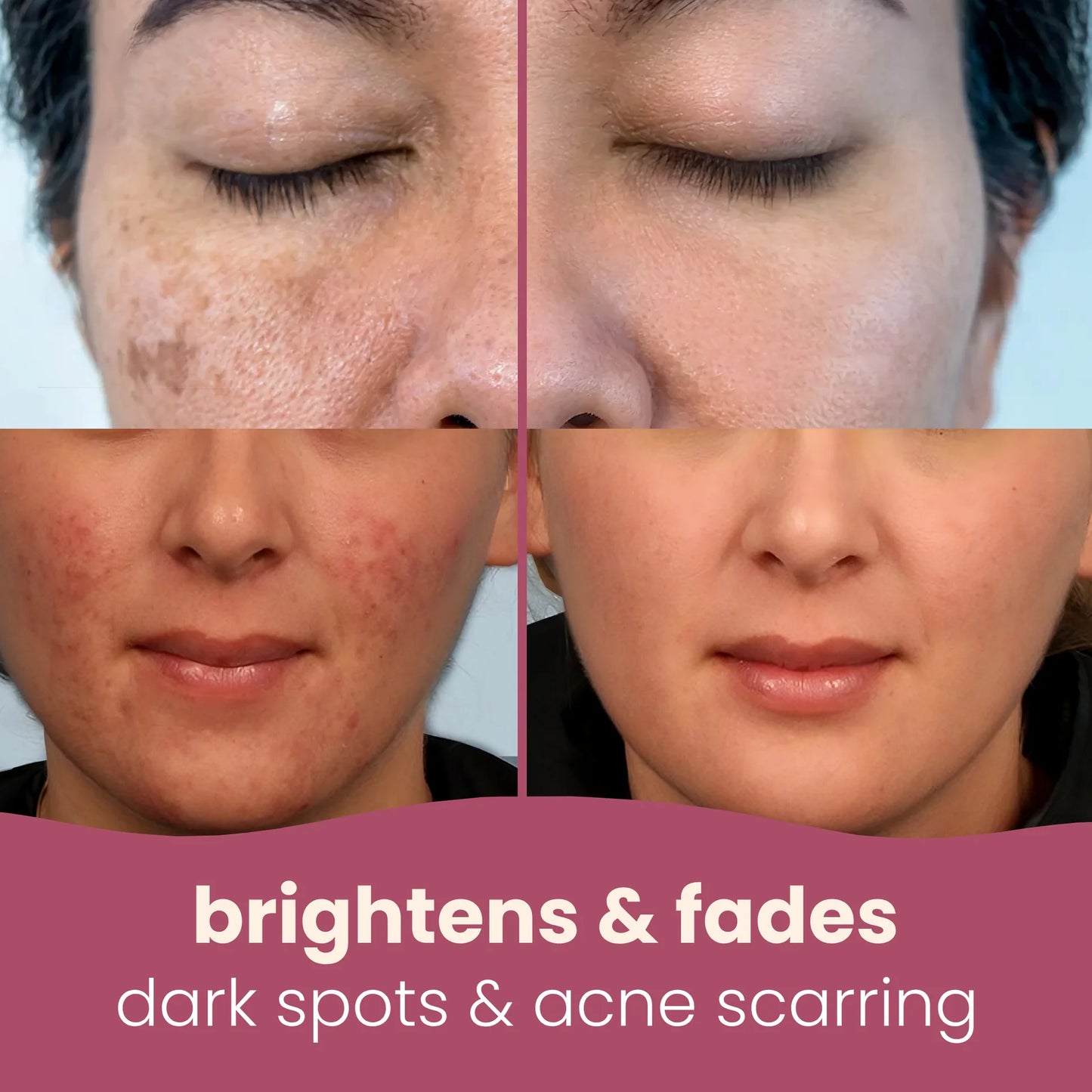 GlowBoost™ Turmeric Pads